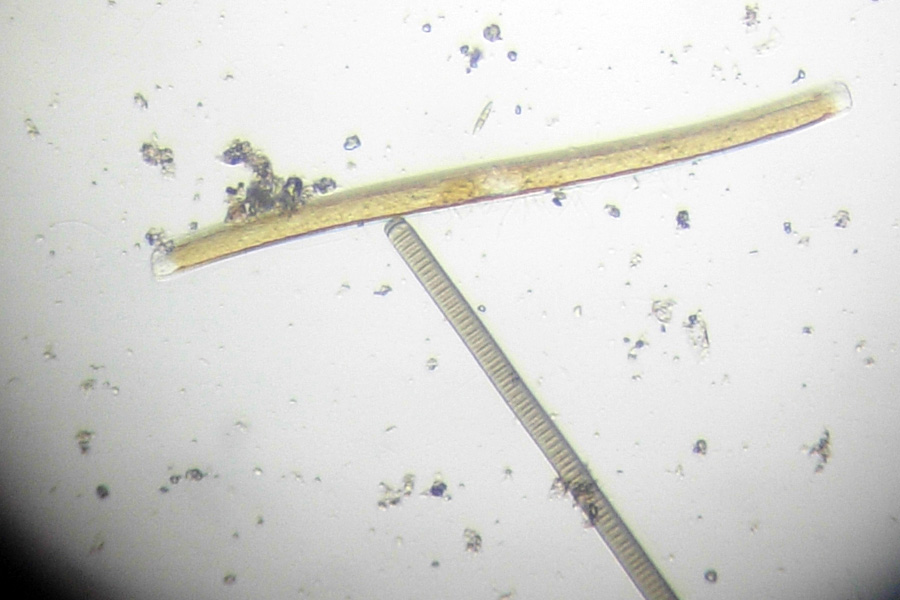 Alghe azzurre al microscopio